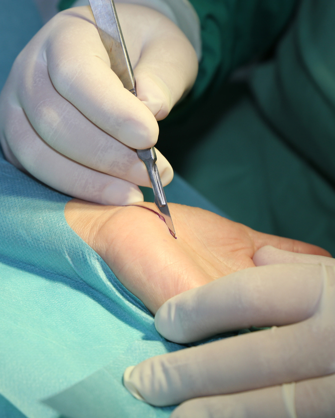 Hand Wrist Elbow Surgery - JACE Private Clinic - Northern Ireland 