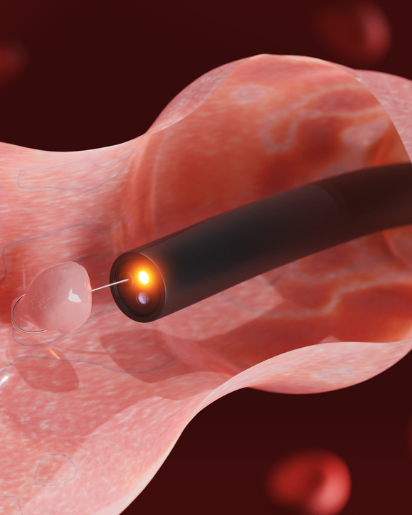 Endoscopy & Gastroenterology Surgery - JACE Private Clinic - Northern Ireland 