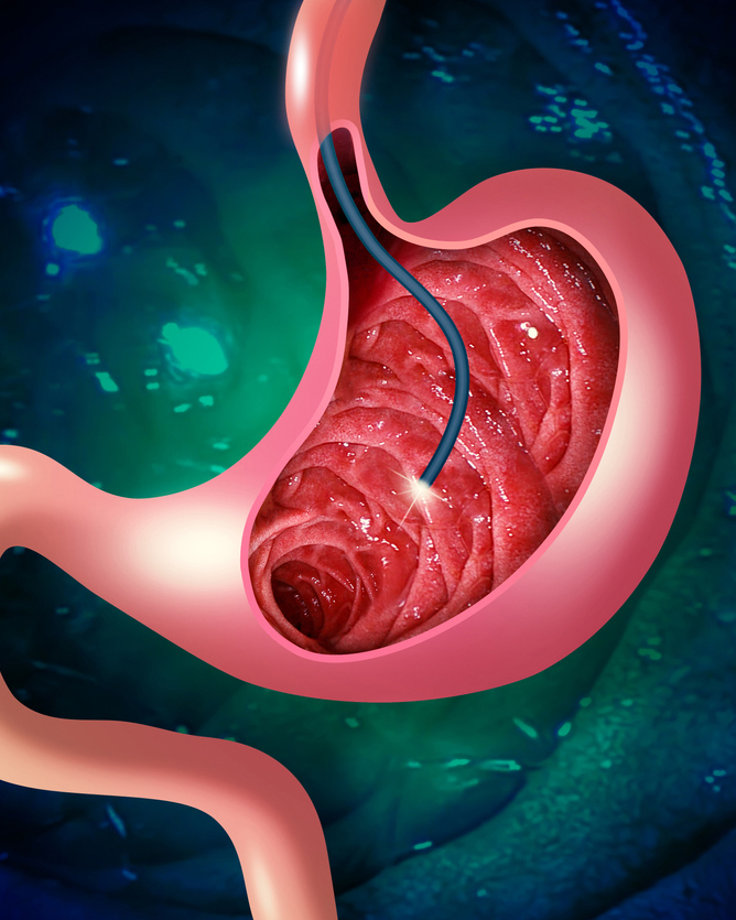 Endoscopy & Gastroenterology Surgery - JACE Private Clinic - Northern Ireland 