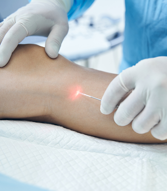 Venous Assessments and Treatments - JACE Private Clinic