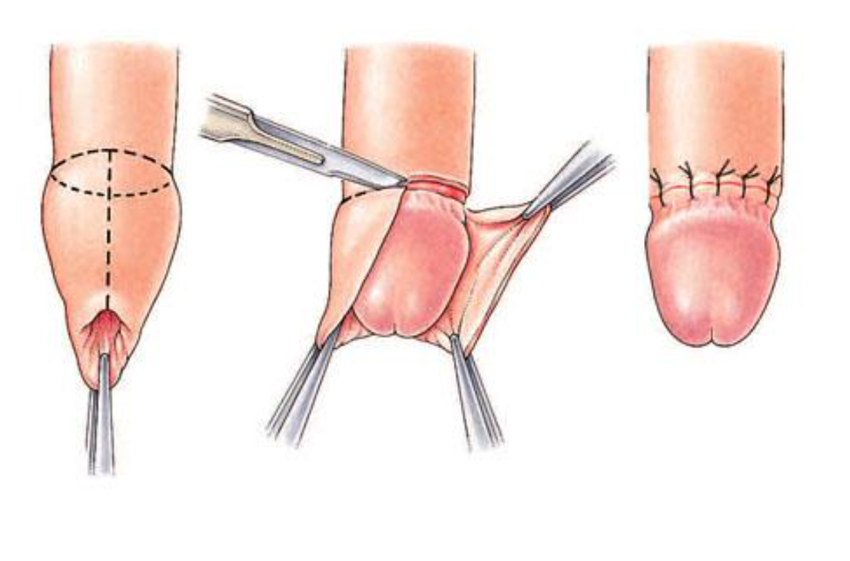 Endoscopy & Gastroenterology Surgery - JACE Private Clinic - Northern Ireland 