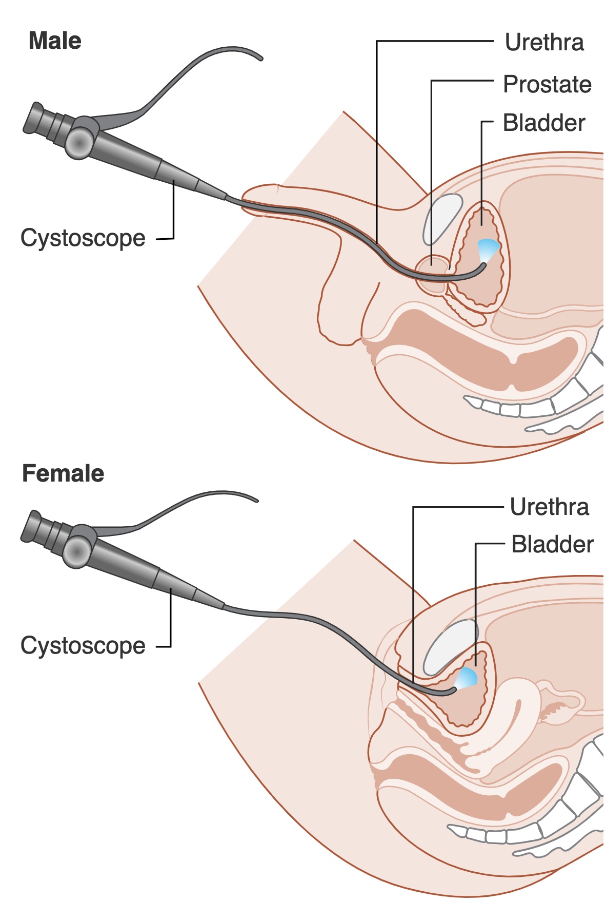 Endoscopy & Gastroenterology Surgery - JACE Private Clinic - Northern Ireland 